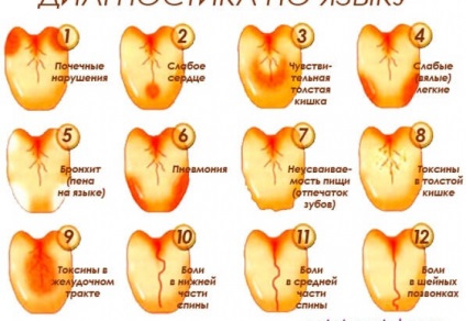 Cum starea limbii va spune despre bolile stomacului