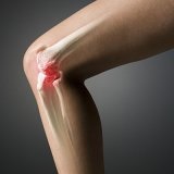 Genunchiul genunchiului - medicina populară - bisturiu - informație medicală și portal educațional