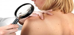 Tratamentul melanomului în trăsăturile de tratament din Germania, clinici cunoscute, nivelul de îngrijire, metode