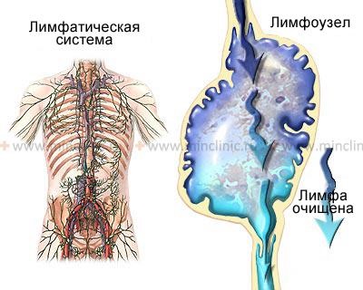 Tratamentul candidozei vulvovaginale