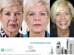 Pericolele legate de botox, chirurgie plastică, liposucție și diverse injecții în timpul întinerirei, personale