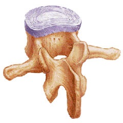 Osteocondroza - tratamentul în 