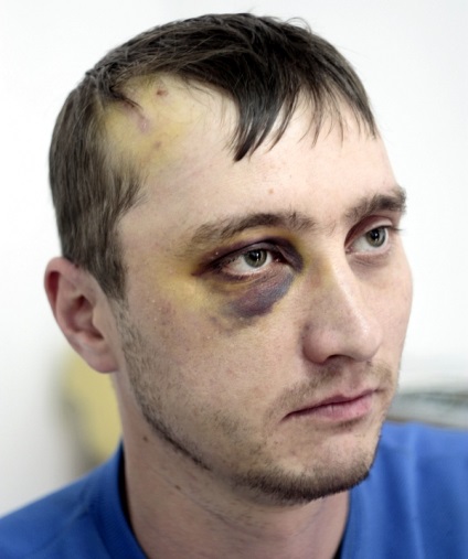 Garda RTS de protecție a bătut omul - orașul kirov - portalul de informații g