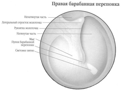 Perforarea timpanului ce este, simptomele, tratamentul