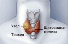 Droguri și medicamente pentru glanda tiroidă