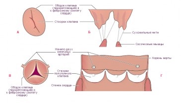 Prolapsul valvei mitrale, cauze, simptome, tratament