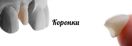Protetice stomatologice preturi, tipuri, în protetica Chelyabinsk de dinți cu furnir, coroane, luminatoare,