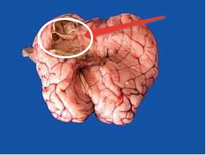 Simptomele creierului oilor și tratamentul acestuia