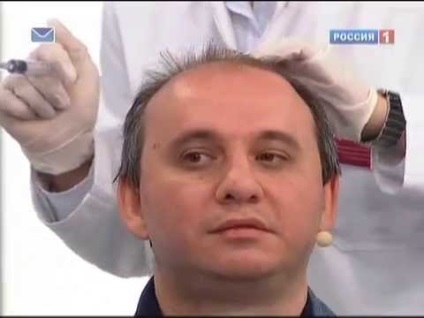 Preparate pentru alopecie la bărbați (remedii de uz farmaceutic și folcloric)