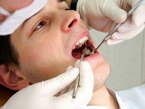 Fistula asupra simptomelor gingiilor și tratamentului la domiciliu