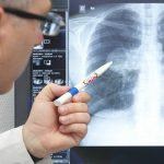 Temperatura la pneumonie la adulți tratamentul pneumoniei, semne, simptome, 38, 39, 37