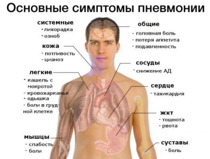 Temperatura la pneumonie la adulți tratamentul pneumoniei, semne, simptome, 38, 39, 37