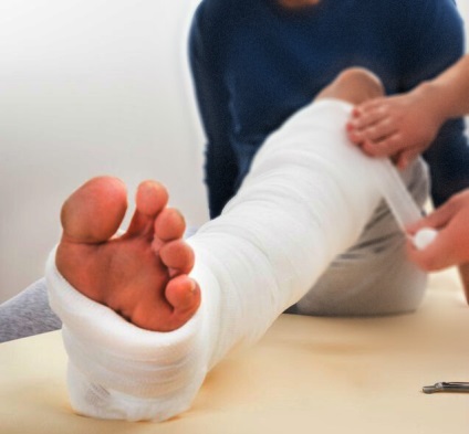Dislocarea piciorului - 5 tipuri, cum să se vindece și să se facă bandaj înainte de sosirea ambulanței