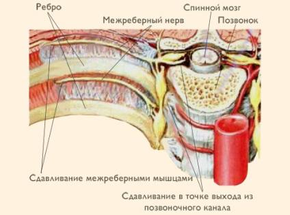 Sárga macula a vese felől a kocsiban