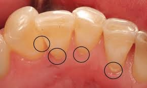 Toothstone - stomatologie 