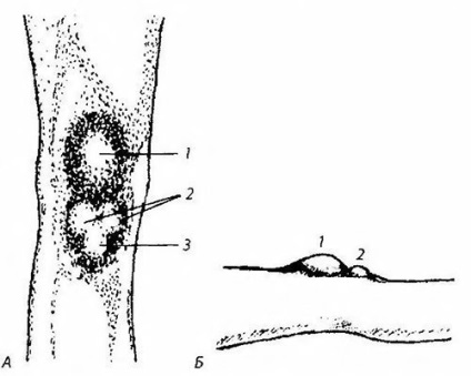 Diagnosticarea articulației genunchiului