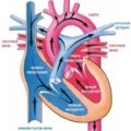 Coardă suplimentară a ventriculului stâng