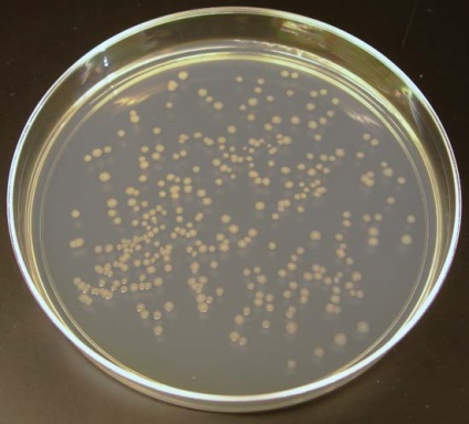 Escherichia coli (E. coli) - proprietăți culturale și biochimice, morfologie e