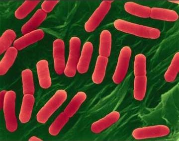 Escherichia coli (E. coli) - proprietăți culturale și biochimice, morfologie e