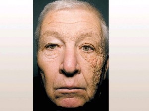 Fotózás vagy barnulás gyorsítja a bőr öregedését
