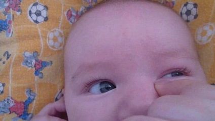 Ochiul unui nou-născut este îngrozitor decât să fie tratat