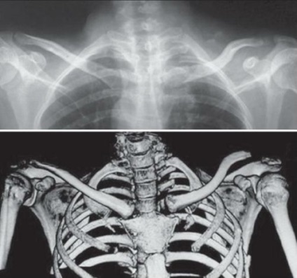 Csont-csuklós ízületi struktúra, funkció és betegség
