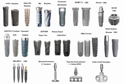 Care sunt cele mai bune implanturi și care dintre ele să aleagă