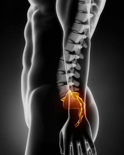 Tratamentul osteocondrozei cu urzica - osteocondroza - cauze, simptome, tratament, diagnostic