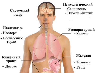 Pneumonia cu cauze și simptome ale gripei porcine