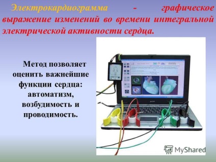 Prezentare pe tema subiectului electrocardiografie