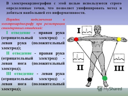 Előadás a téma előadás témájáról EKG