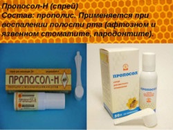 Propolis spray - recuperare rapidă a durerilor în gât