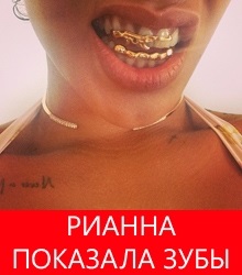 Rihanna a arătat o cultură populară a dinților de aur