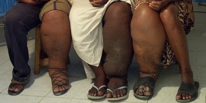 Cele mai neobișnuite boli în fotografiile și descrierile oamenilor, vivareit