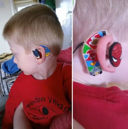 A kreatív anya fia zavarba jött, hogy viselje a hallókészülékét