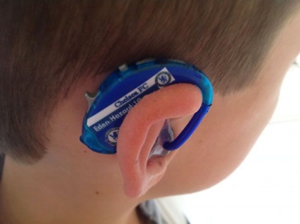 Fiul unei mame creative a fost jenat să-și poarte aparatul auditiv
