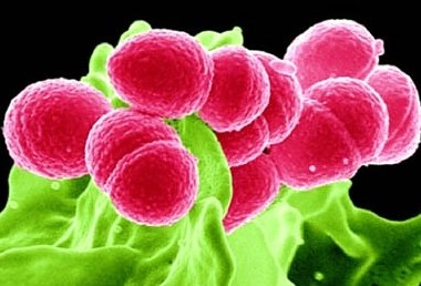 Grupul Streptococcus a - streptococ hemolitic