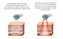 ултразвукова устройство