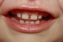 зъби