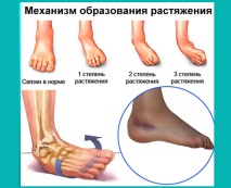 крака вената