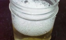 Разпенващата се урина причинява пяна при уриниране при мъже и жени