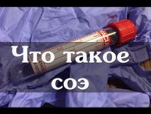 онкологията рецепти