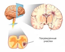 причини