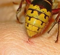 Alergia la insecte înțeapă simptome și metode de tratament sale (alergie) Alergii la intepaturi de insecte simptomele și tratamentele sale