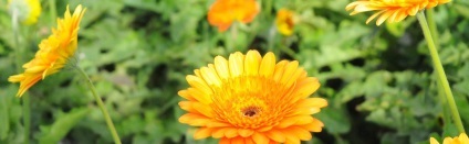 Alopecia (chelie), la bărbați (alopecie) Alopecia (chelie) la bărbați