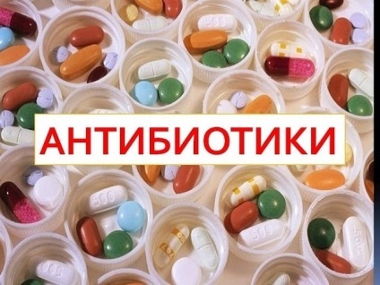 Antibiotice în inflamație a gingiilor și a dinților după îndepărtarea și tratamentul copiilor și adulților (antibiotice) Antibiotice pentru inflamarea gingiilor și a dinților după îndepărtarea și tratamentul copiilor și adulților