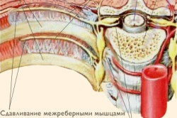 Ce se poate face în cazul în care inima colita (Care sunt motivele) Ce se poate face în cazul în care inima colita