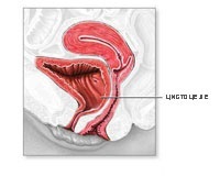 Cystocele, ajuta la Institutul de Urologie (cistocel) Cystocele, ajuta la Institutul de Urologie