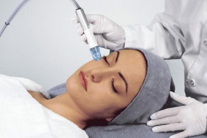Dermabraziunea comentarii, tipuri, indicații, preturi (review-uri) Dermabraziunea comentarii, tipuri, indicații, prețurile