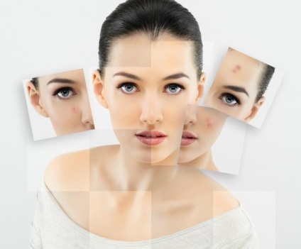 Dermabraziunea comentarii, tipuri, indicații, prețuri (de indicație) Dermabraziunea comentarii, tipuri, indicații, prețurile